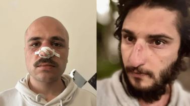 Georgian Police Injure Journalists Covering “Foreign Agent” Protests Amid Press Crackdown