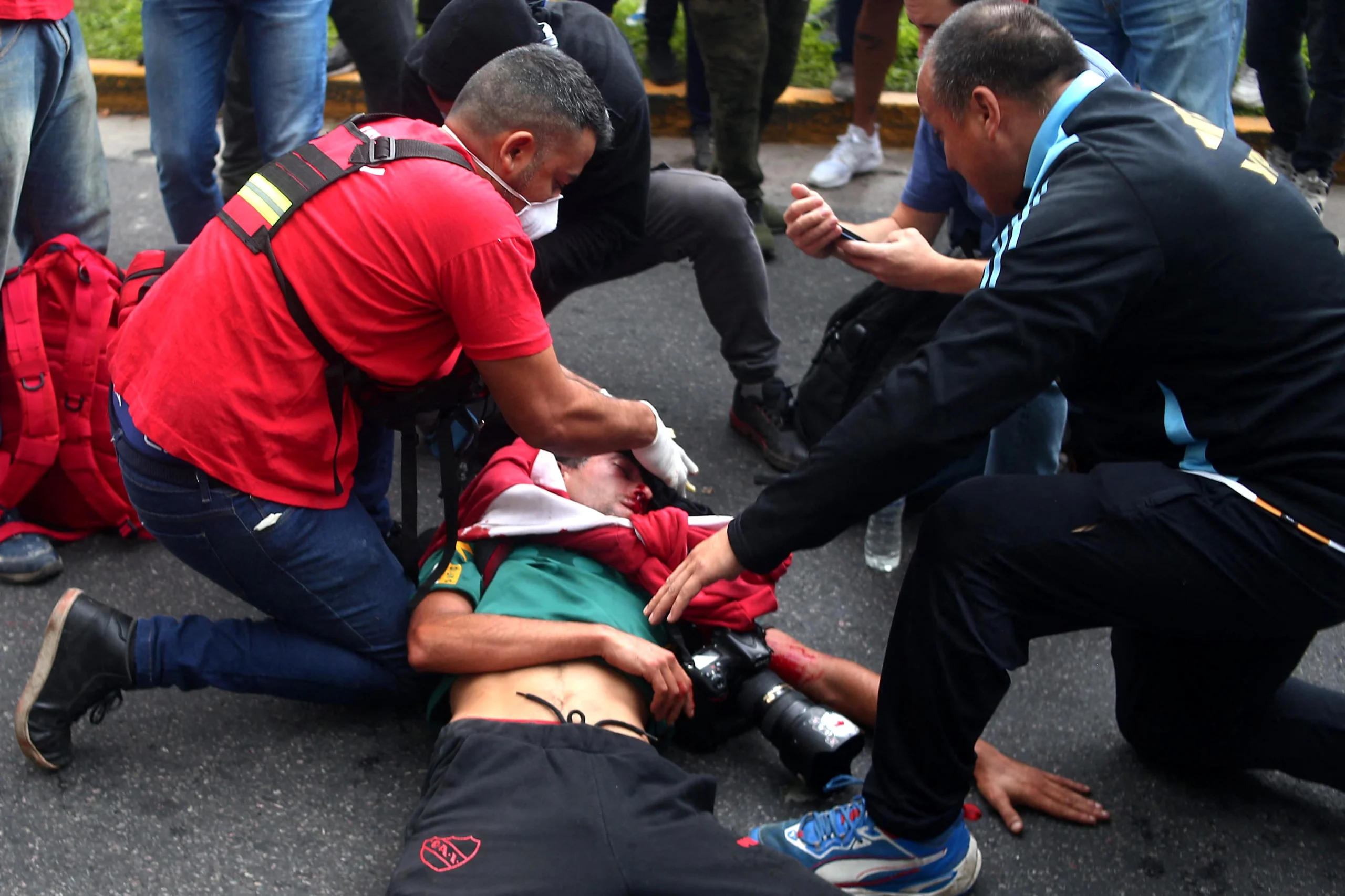 Argentine Photojournalist Critically Injured Amid Violent Anti-Milei Protest