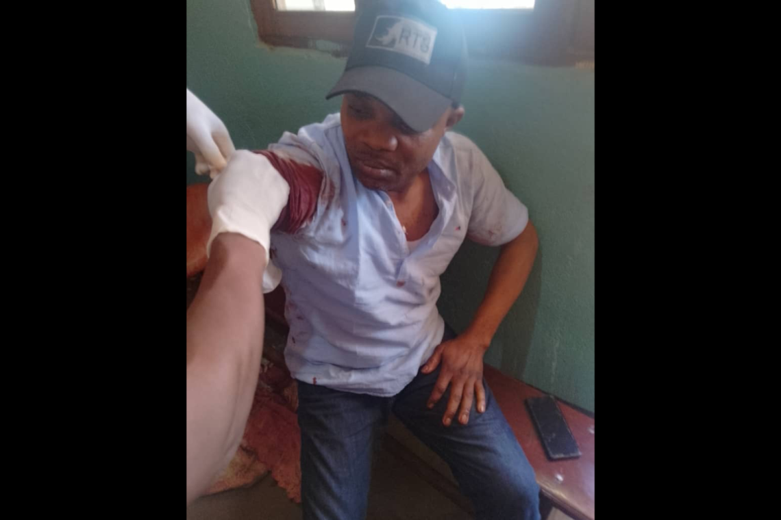 DRC Journalist Shot by Police While Covering Protest in Haut-Uélé