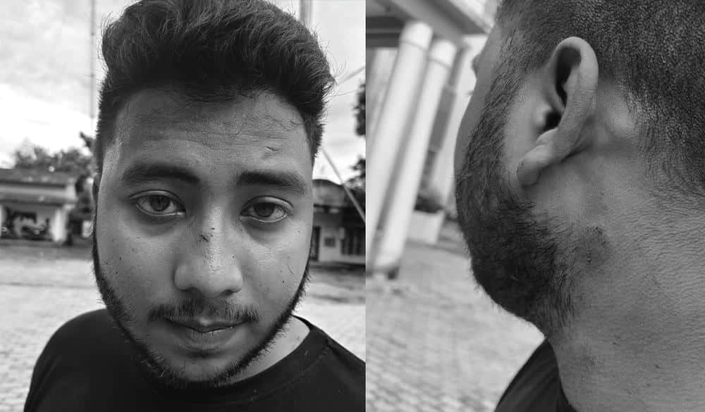 Assam Journalist Beaten by Mob While Reporting, Sparking Outcry Over Rising Attacks on Press