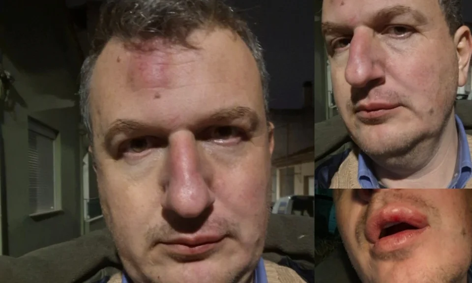 Greek Journalist Assaulted Outside Home in Volos, Triggering Widespread Condemnation